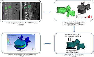 Influence of image reconstruction kernel on computed tomography-based finite element analysis in the clinical opportunistic screening of osteoporosis—A preliminary result